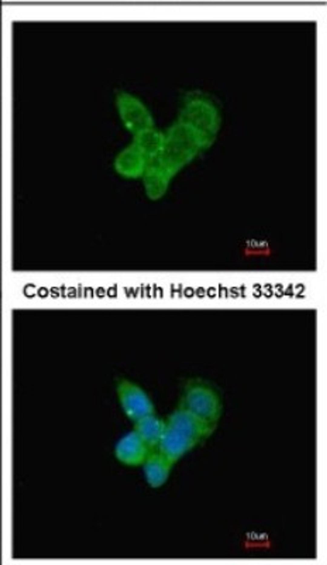 Immunocytochemistry/Immunofluorescence: Complement C9 Antibody [NBP2-15952] - Immunofluorescence analysis of methanol-fixed HepG2, using antibody at 1:200 dilution.