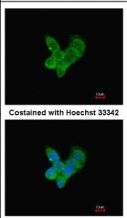 Immunocytochemistry/Immunofluorescence: Complement C9 Antibody [NBP2-15952] - Immunofluorescence analysis of methanol-fixed HepG2, using antibody at 1:200 dilution.