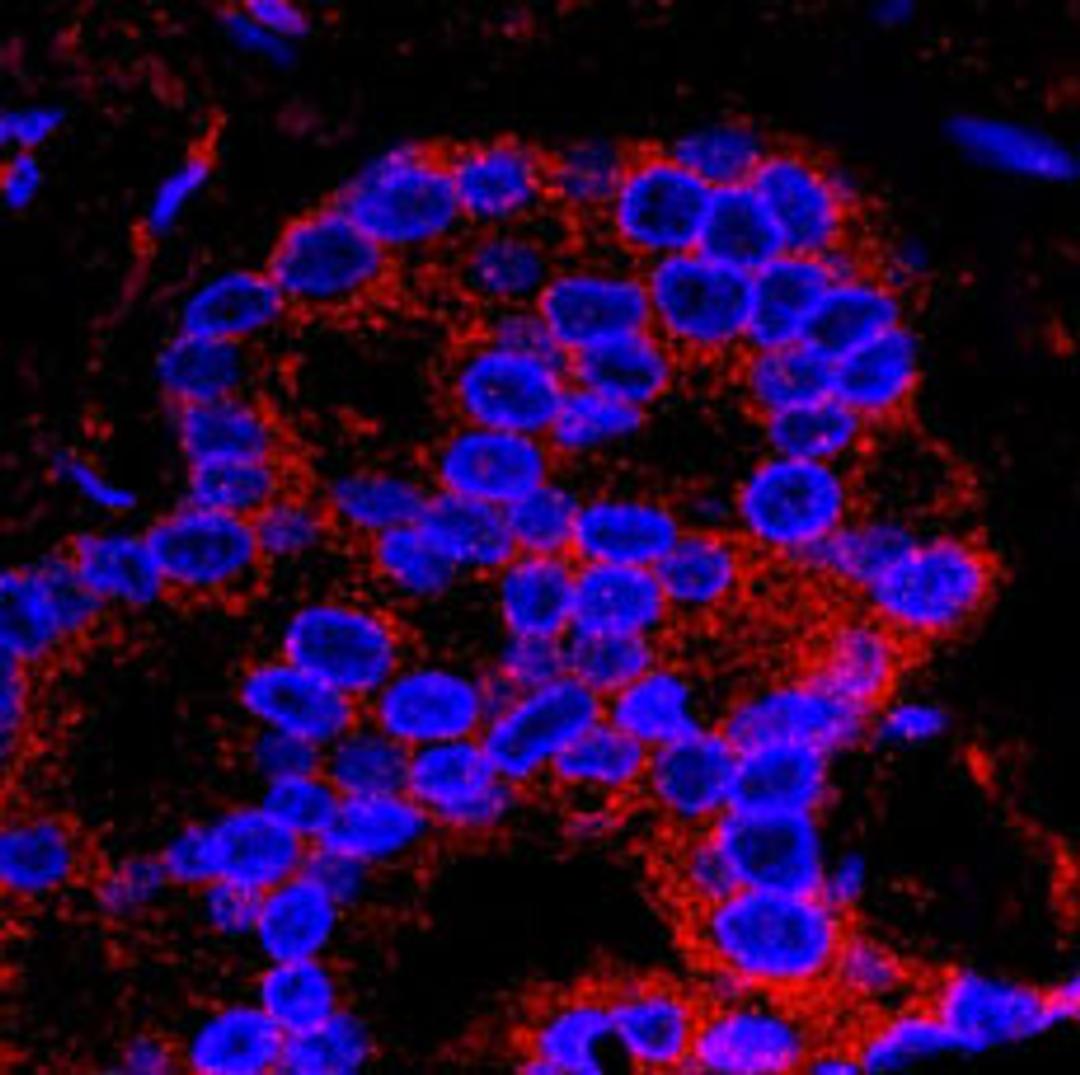 Detection of human Flightless-1 by IHC-IF.