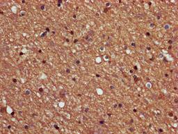IHC image of CSB-PA018565LA01HU diluted at 1:600 and staining in paraffin-embedded human brain tissue performed on a Leica BondTM system. After dewaxing and hydration, antigen retrieval was mediated by high pressure in a citrate buffer (pH 6.0). Section was blocked with 10% normal goat serum 30min at RT. Then primary antibody (1% BSA) was incubated at 4°C overnight. The primary is detected by a biotinylated secondary antibody and visualized using an HRP conjugated SP system.