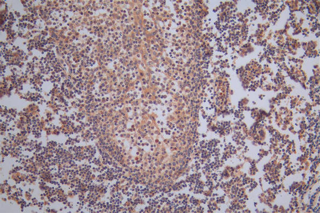 IHC image of CSB-RA008642MA1HU diluted at 1:50 and staining in paraffin-embedded human tonsil tissue performed on a Leica BondTM system. After dewaxing and hydration,  antigen retrieval was mediated by high pressure in a citrate buffer (pH 6.0). Section was blocked with 10% normal goat serum 30min at RT. Then primary antibody (1% BSA) was incubated at 4°C overnight. The primary is detected by a Goat anti-Rabbit IgG labeled by HRP and visualized using 0.05% DAB.