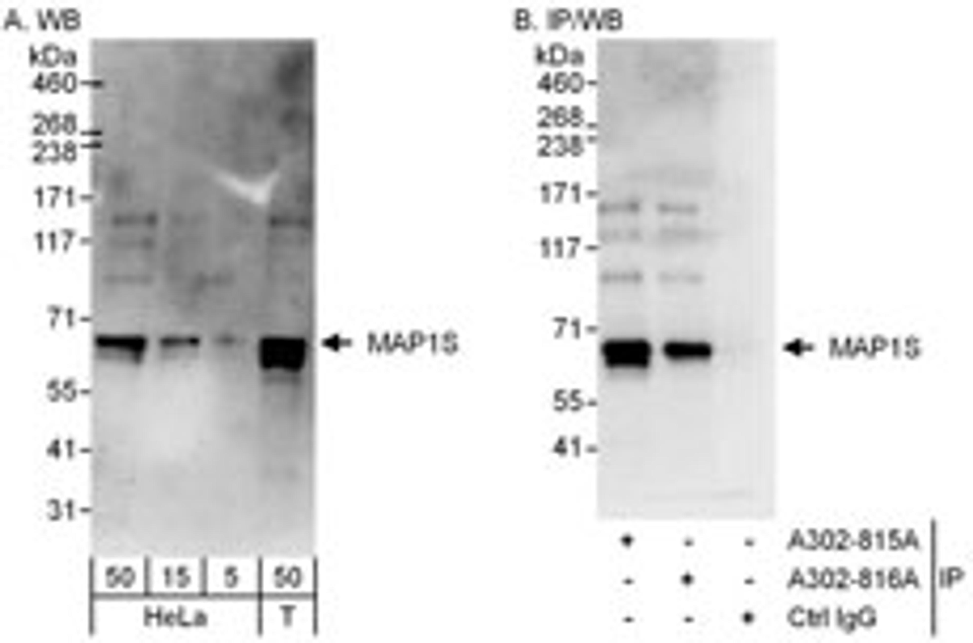 Detection of human MAP1S by western blot and immunoprecipitation.