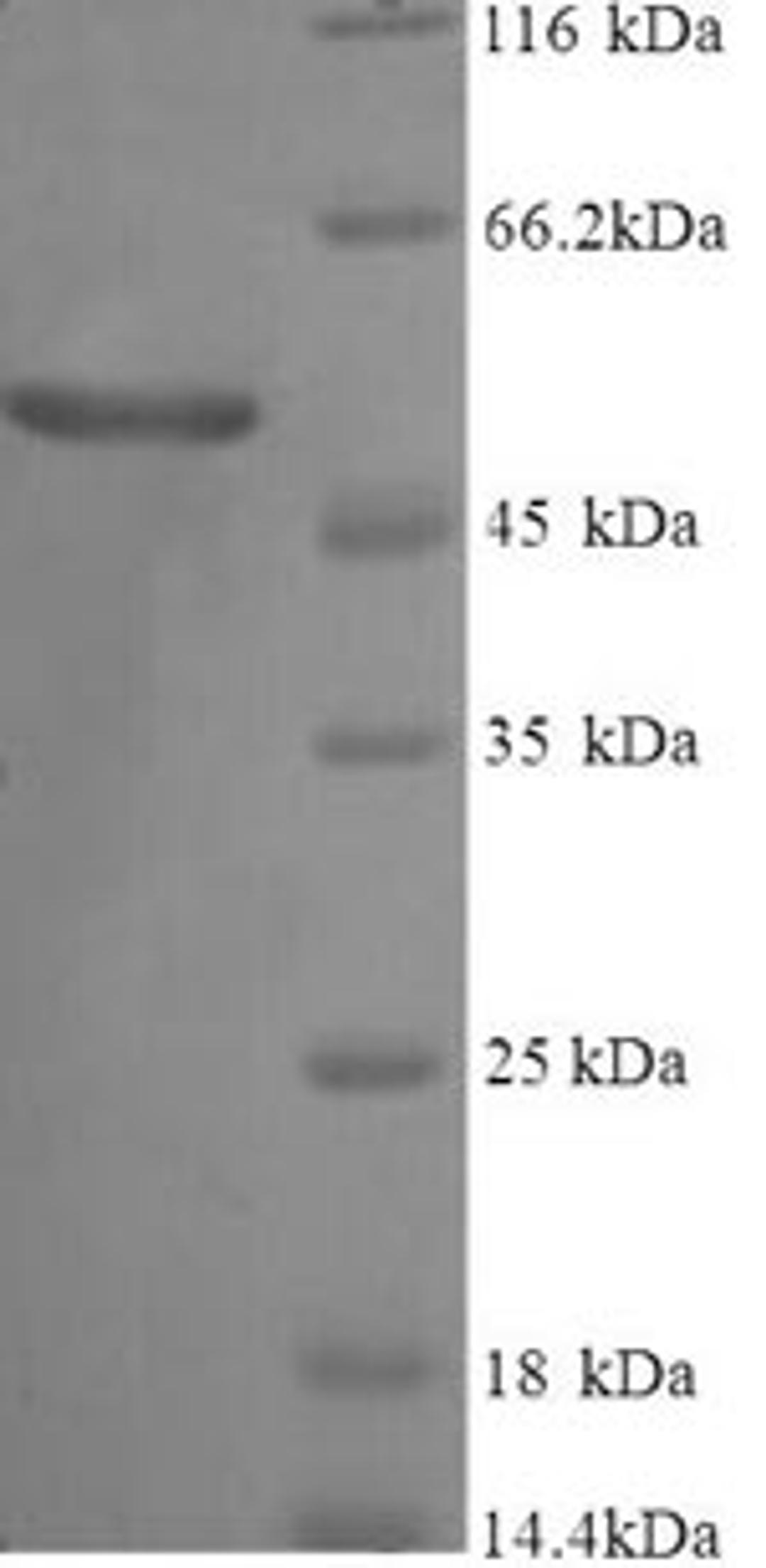 (Tris-Glycine gel) Discontinuous SDS-PAGE (reduced) with 5% enrichment gel and 15% separation gel.