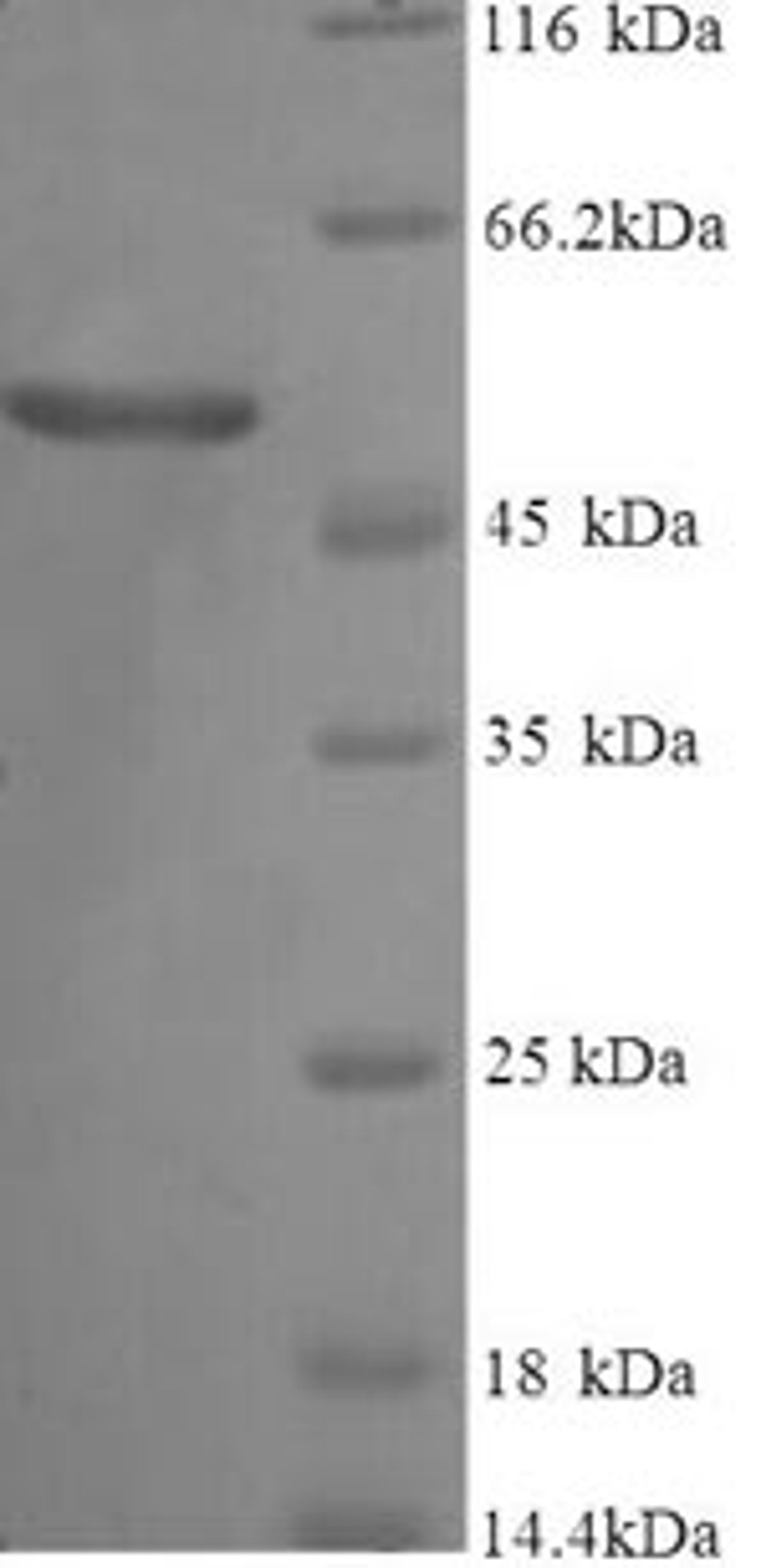 (Tris-Glycine gel) Discontinuous SDS-PAGE (reduced) with 5% enrichment gel and 15% separation gel.