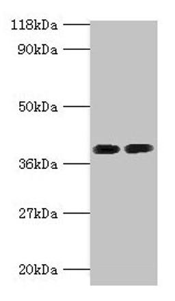 Western blot. All lanes: ANXA2 antibody at 2µg/ml. Lane 1: 293T whole cell lysate. Lane 2: EC109 whole cell lysate. Secondary. Goat polyclonal to rabbit IgG at 1/15000 dilution. Predicted band size: 39, 41 kDa. Observed band size: 39 kDa