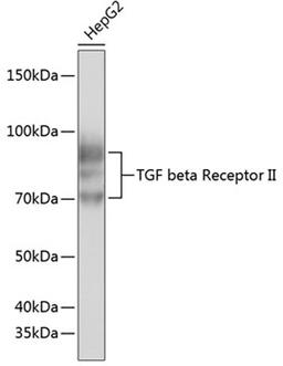 Western blot - TGF beta Receptor II antibody (A19124)