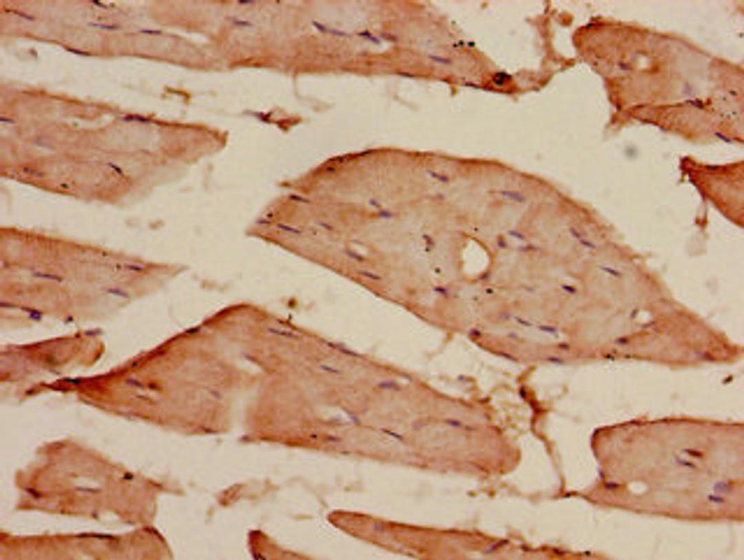 Immunohistochemistry of paraffin-embedded human skeletal muscle tissue using CSB-PA716574LA01HU at dilution of 1:100