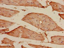 Immunohistochemistry of paraffin-embedded human skeletal muscle tissue using CSB-PA716574LA01HU at dilution of 1:100