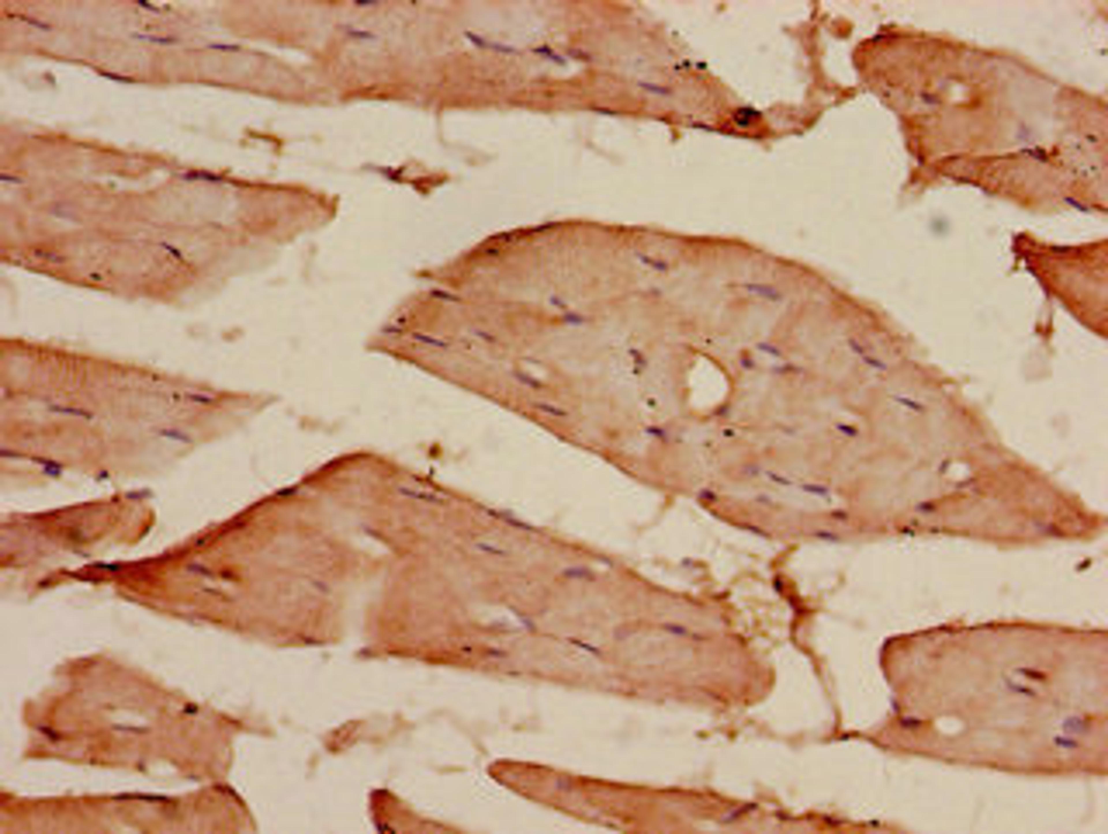 Immunohistochemistry of paraffin-embedded human skeletal muscle tissue using CSB-PA716574LA01HU at dilution of 1:100