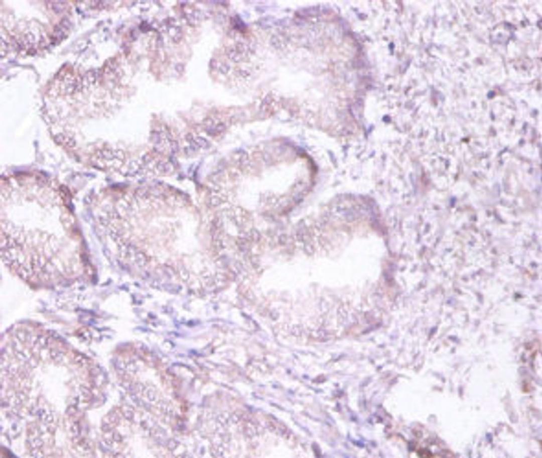 Immunohistochemistry of paraffin-embedded human prostate tissue using CSB-PA00575A0Rb at dilution of 1:100