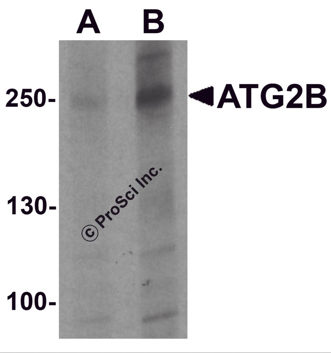 Western blot analysis of ATG2B in K562 cell lysate with ATG2B antibody at (A) 1 and (B) 2 &#956;g/ml