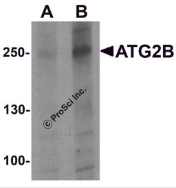 Western blot analysis of ATG2B in K562 cell lysate with ATG2B antibody at (A) 1 and (B) 2 &#956;g/ml