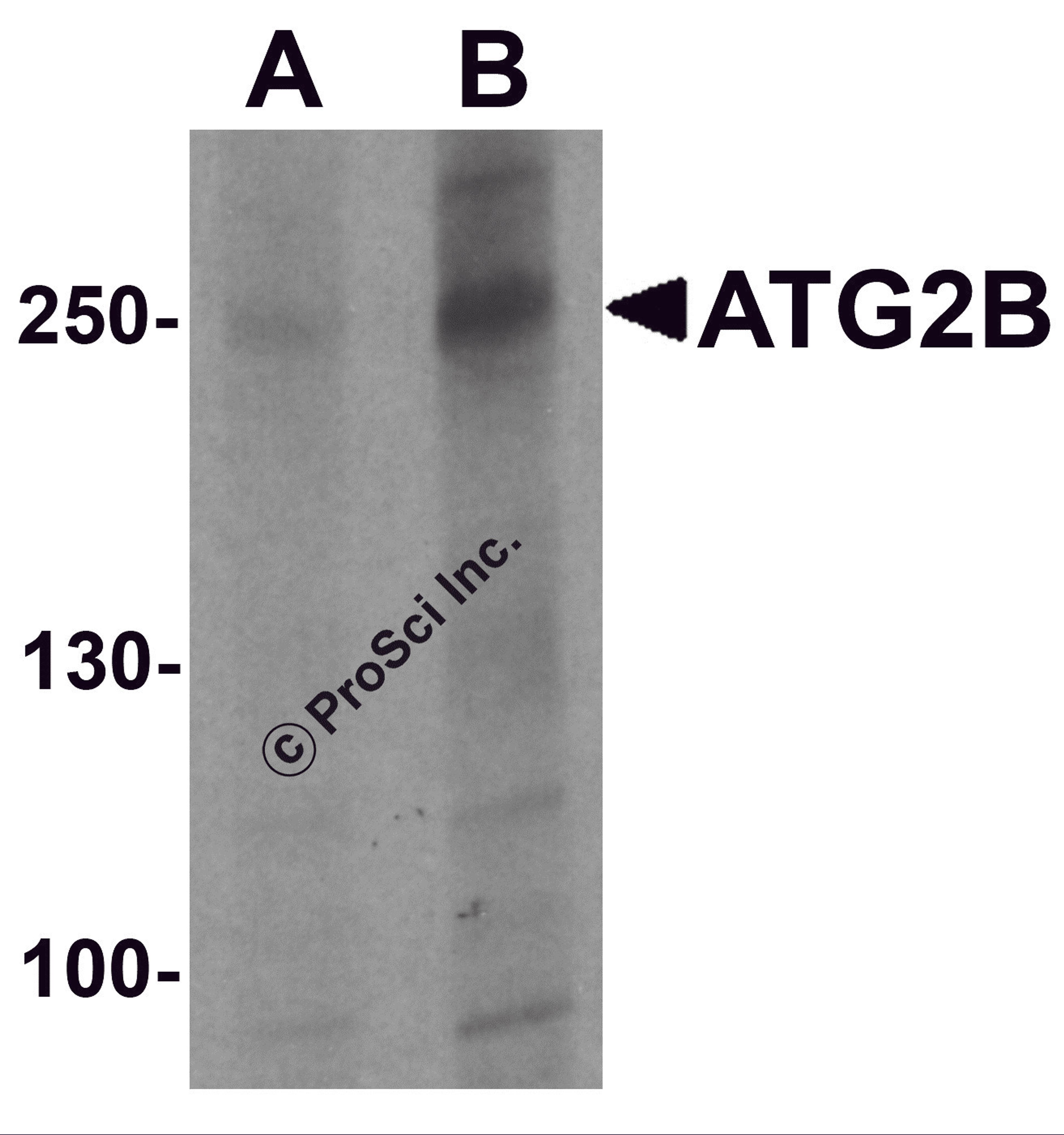 Western blot analysis of ATG2B in K562 cell lysate with ATG2B antibody at (A) 1 and (B) 2 &#956;g/ml