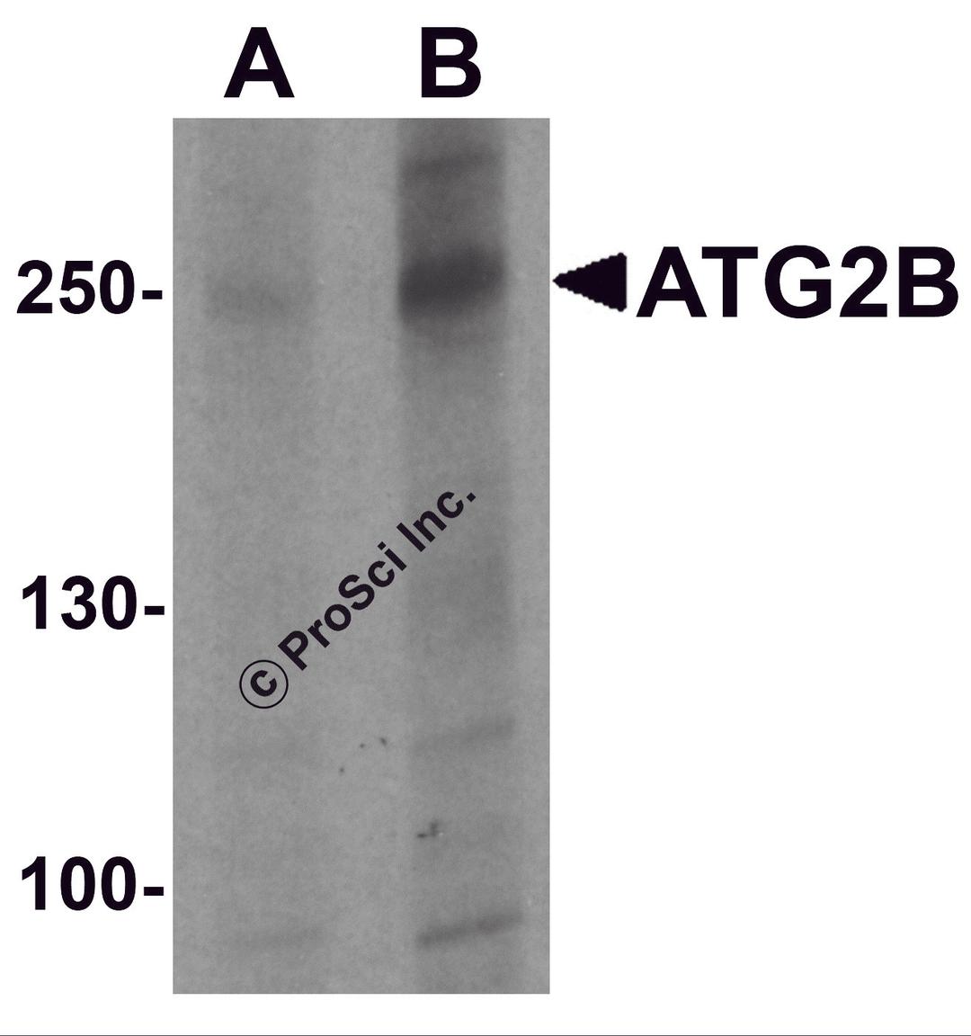 Western blot analysis of ATG2B in K562 cell lysate with ATG2B antibody at (A) 1 and (B) 2 μg/ml