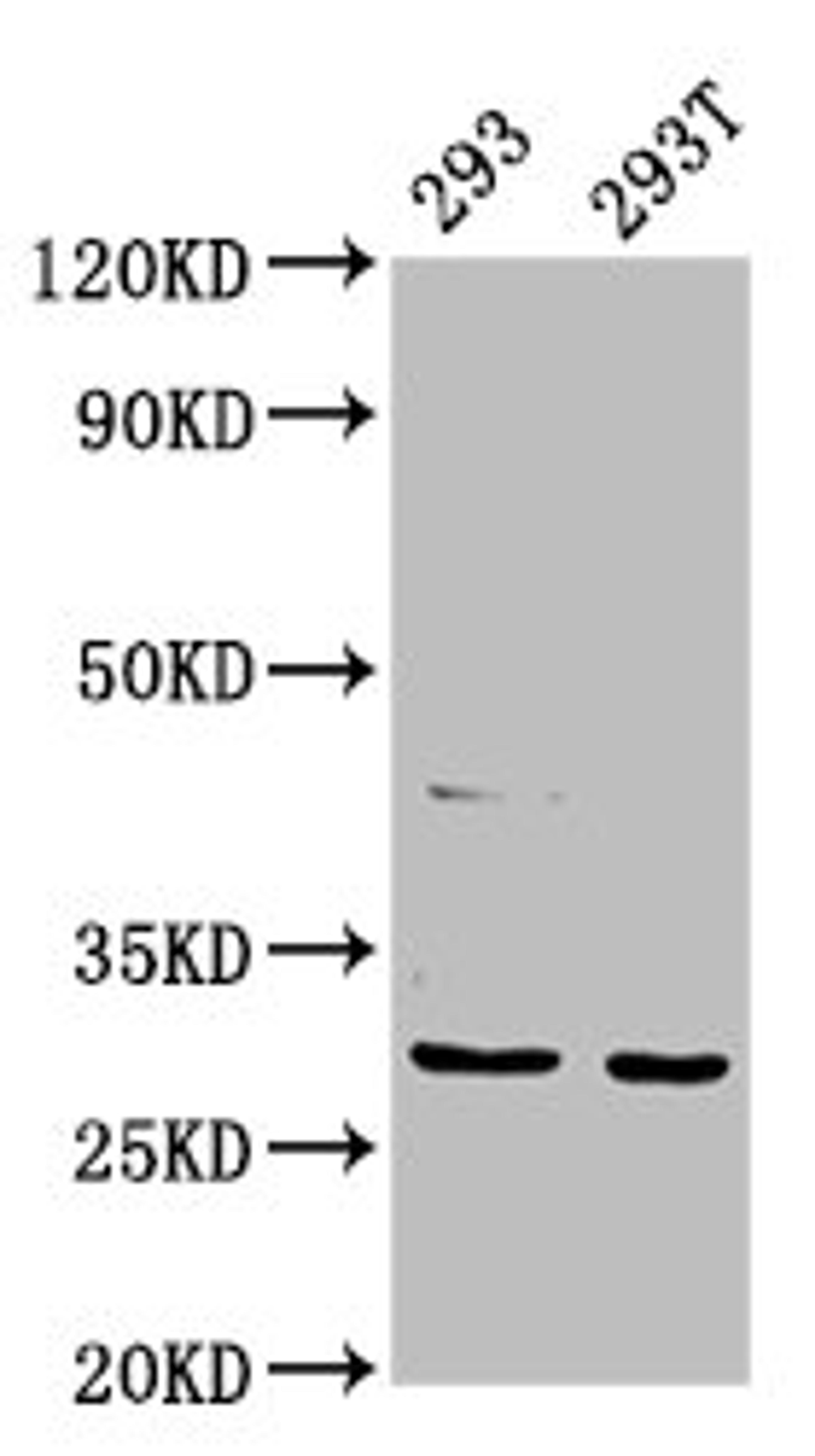Western Blot. Positive WB detected in: 293 whole cell lysate, 293T whole cell lysate. All lanes: AANAT antibody at 7.5ug/ml. Secondary. Goat polyclonal to rabbit IgG at 1/50000 dilution. Predicted band size: 24, 29 kDa. Observed band size: 29 kDa.