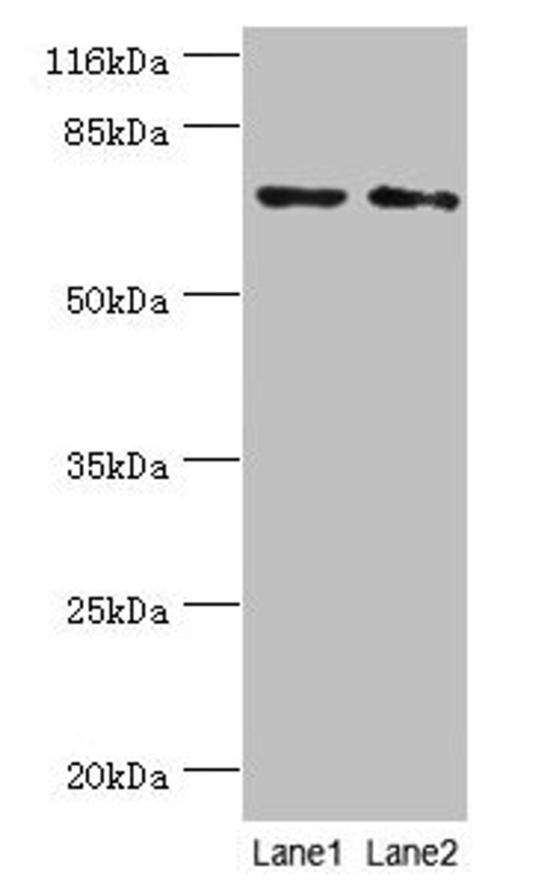 Western blot. All lanes: MAGEC3 antibody at 2µg/ml. Lane 1: A375 whole cell lysate. Lane 2: Rat thymus tissue. Secondary. Goat polyclonal to rabbit IgG at 1/10000 dilution. Predicted band size: 72, 39 kDa. Observed band size: 72 kDa