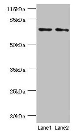 Western blot. All lanes: MAGEC3 antibody at 2µg/ml. Lane 1: A375 whole cell lysate. Lane 2: Rat thymus tissue. Secondary. Goat polyclonal to rabbit IgG at 1/10000 dilution. Predicted band size: 72, 39 kDa. Observed band size: 72 kDa