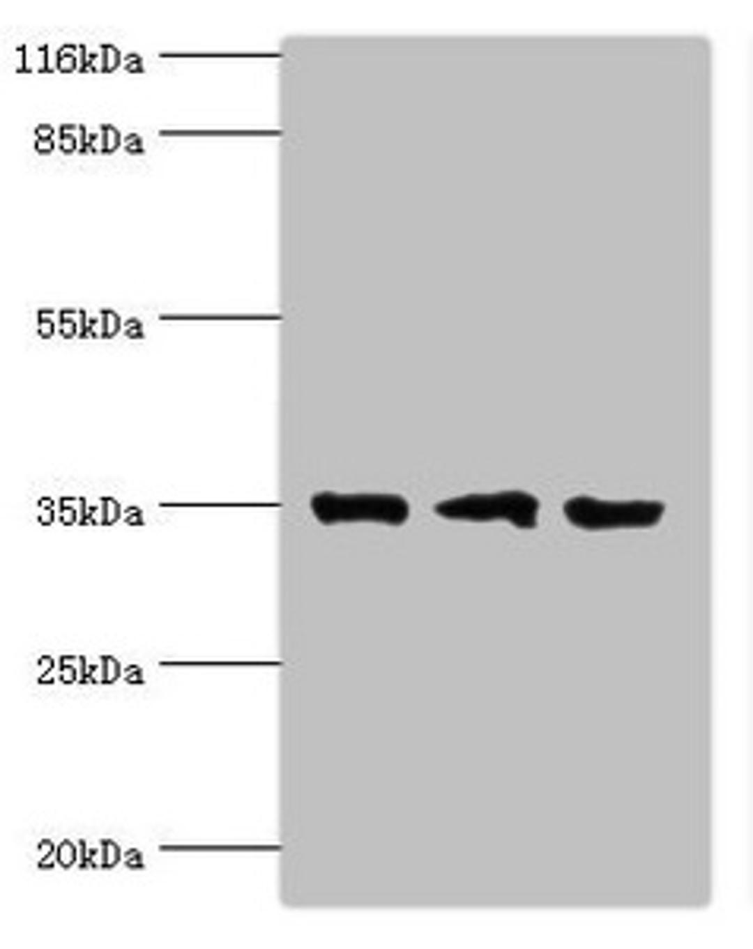 Western blot. All lanes: Rab effector Noc2 antibody at 2ug/ml. Lane 1: Rat liver tissue. Lane 2: K562 whole cell lysate. Lane 3: A549 whole cell lysate. Secondary. Goat polyclonal to rabbit IgG at 1/10000 dilution. Predicted band size: 35, 32 kDa. Observed band size: 35 kDa.