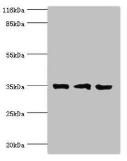 Western blot. All lanes: Rab effector Noc2 antibody at 2ug/ml. Lane 1: Rat liver tissue. Lane 2: K562 whole cell lysate. Lane 3: A549 whole cell lysate. Secondary. Goat polyclonal to rabbit IgG at 1/10000 dilution. Predicted band size: 35, 32 kDa. Observed band size: 35 kDa.