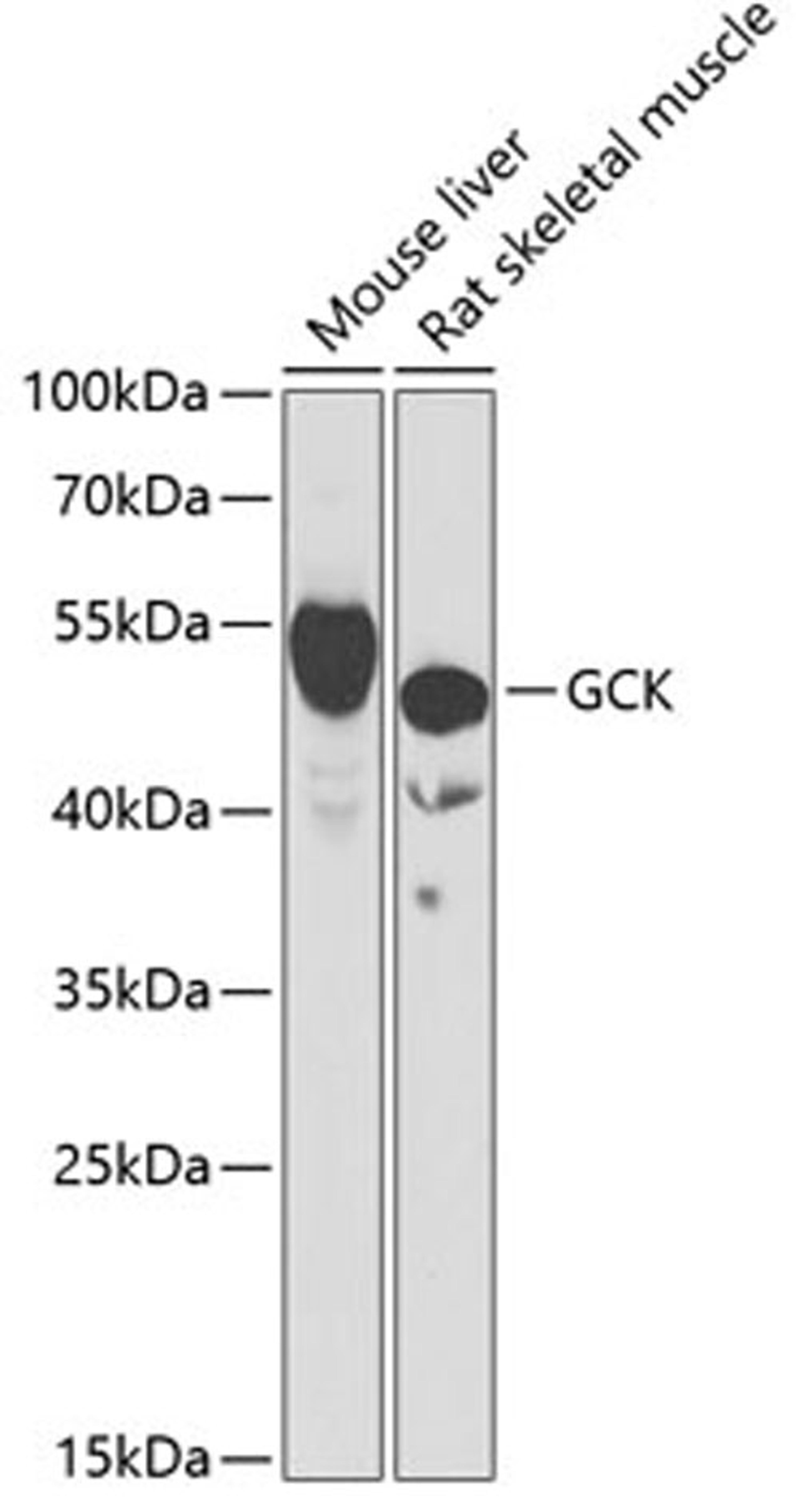 Western blot - GCK antibody (A6293)