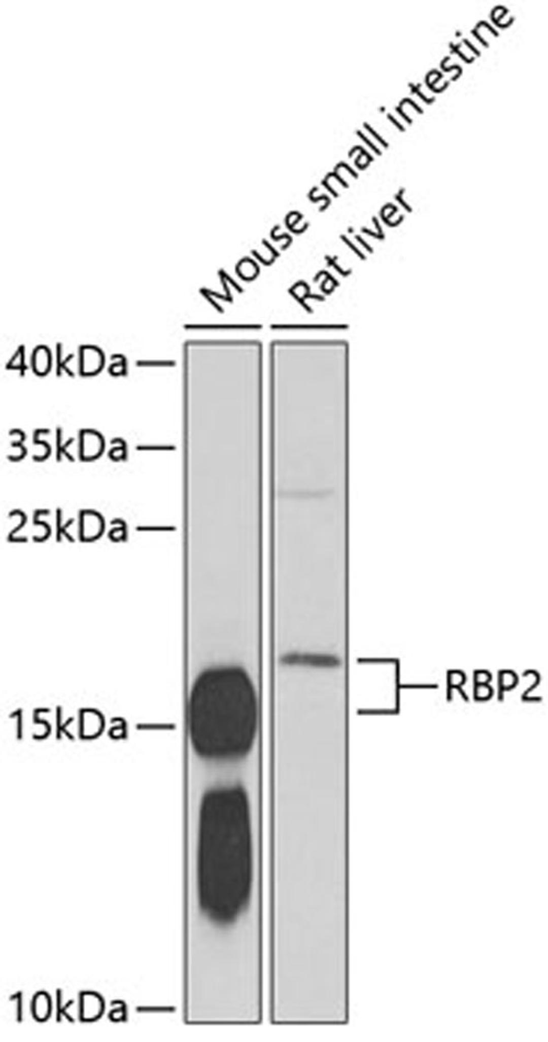 Western blot - RBP2 antibody (A6717)