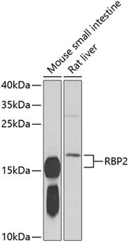 Western blot - RBP2 antibody (A6717)