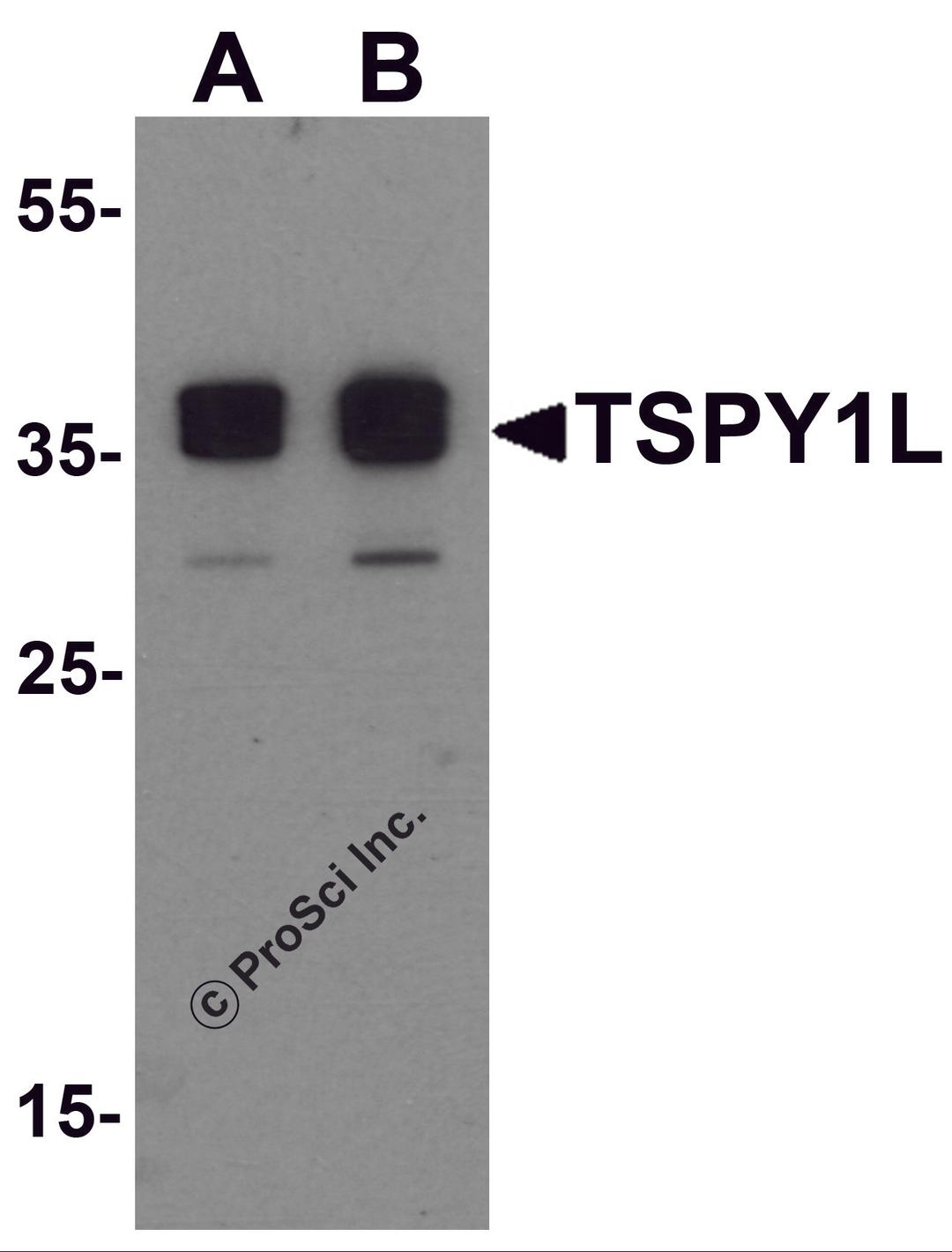 Western blot analysis of TSPY1L in A20 cell lysate with TSPY1L antibody at (A) 0.5 and (B) 1 μg/mL