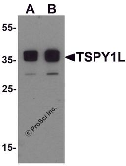 Western blot analysis of TSPY1L in A20 cell lysate with TSPY1L antibody at (A) 0.5 and (B) 1 μg/mL