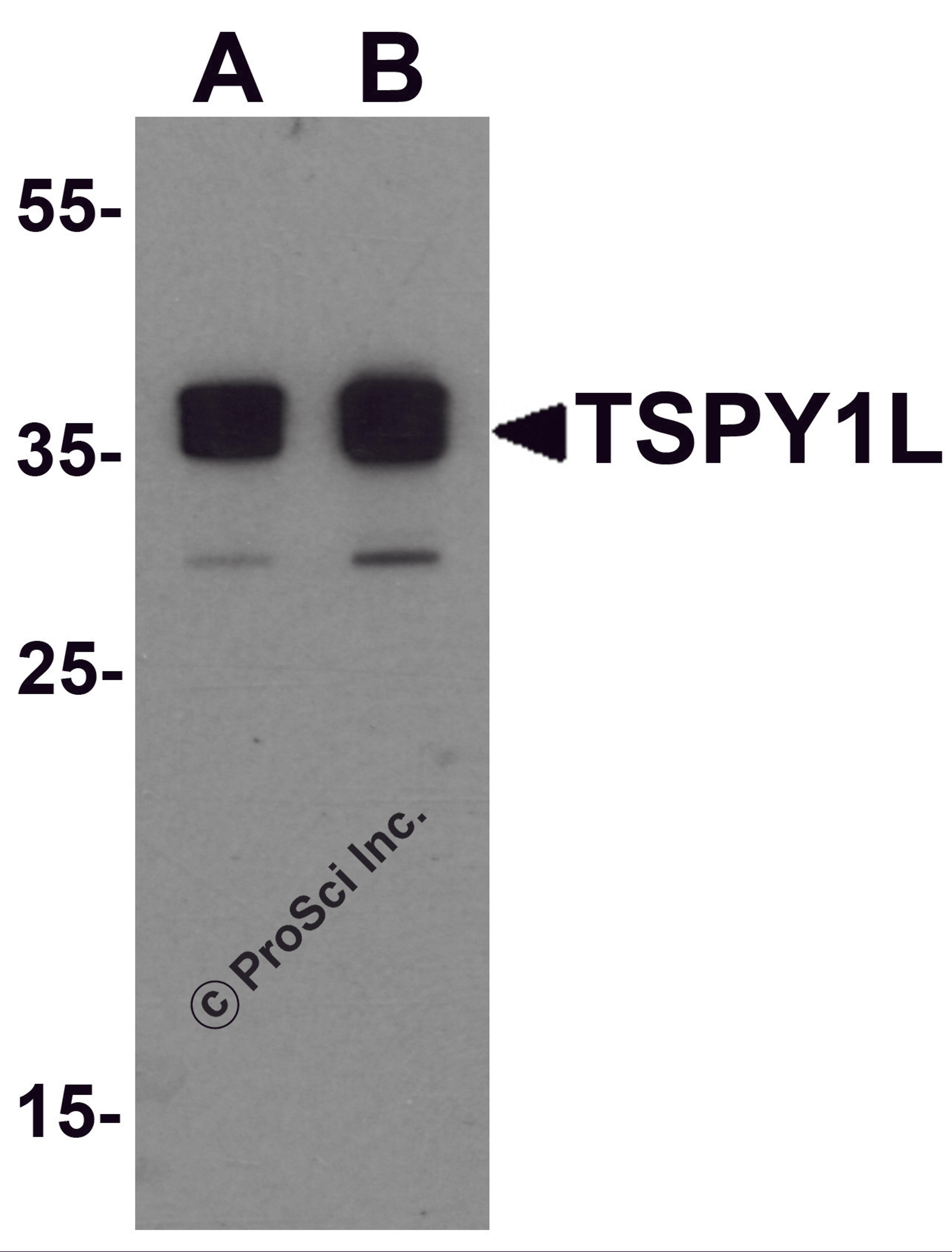 Western blot analysis of TSPY1L in A20 cell lysate with TSPY1L antibody at (A) 0.5 and (B) 1 μg/mL