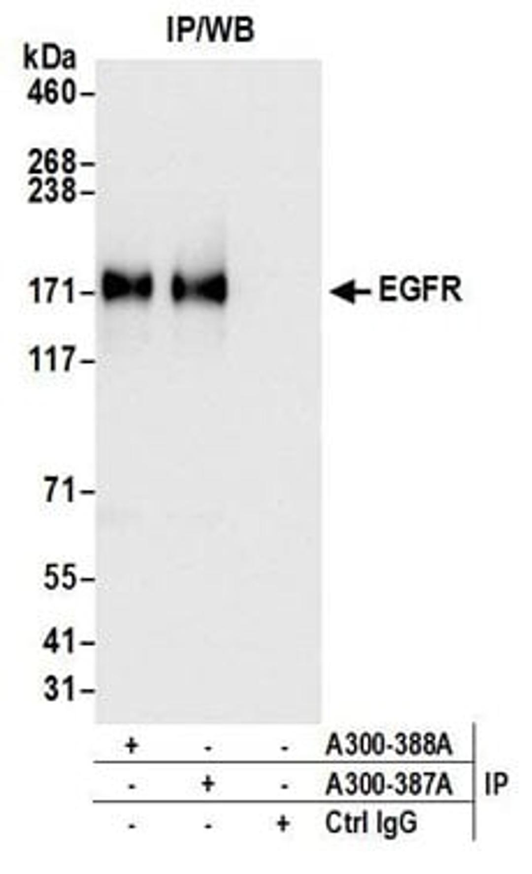 Detection of human EGFR by western blot of immunoprecipitates.