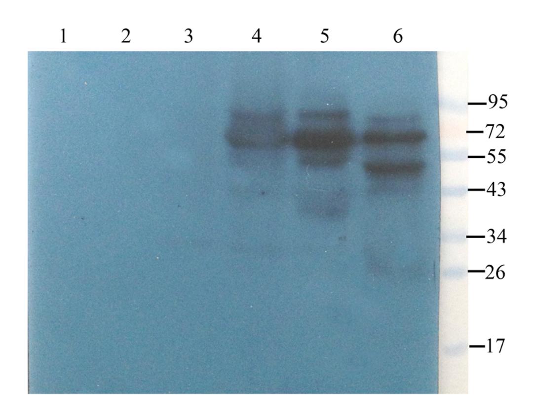 WB analysis of rat lymph node (lane 1), rat spinal cord (lane 2), mouse medulla (lane 3), rat thymus (lane 4), rat thyroid (lane 5), mouse spleen (lane 6) using ZNT8 antibody (2.5 ug/ml)