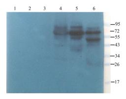 WB analysis of rat lymph node (lane 1), rat spinal cord (lane 2), mouse medulla (lane 3), rat thymus (lane 4), rat thyroid (lane 5), mouse spleen (lane 6) using ZNT8 antibody (2.5 ug/ml)