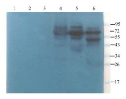 WB analysis of rat lymph node (lane 1), rat spinal cord (lane 2), mouse medulla (lane 3), rat thymus (lane 4), rat thyroid (lane 5), mouse spleen (lane 6) using ZNT8 antibody (2.5 ug/ml)