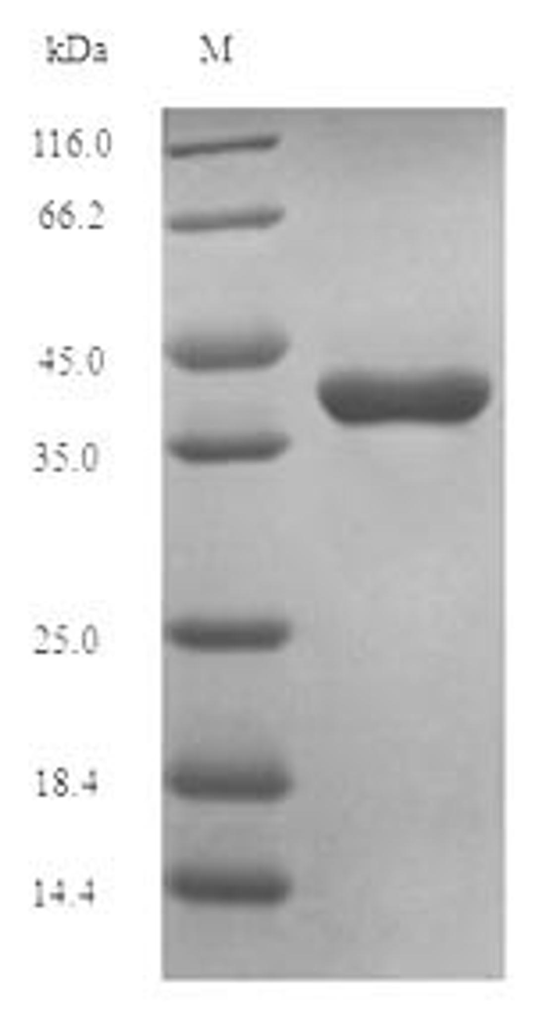 (Tris-Glycine gel) Discontinuous SDS-PAGE (reduced) with 5% enrichment gel and 15% separation gel.