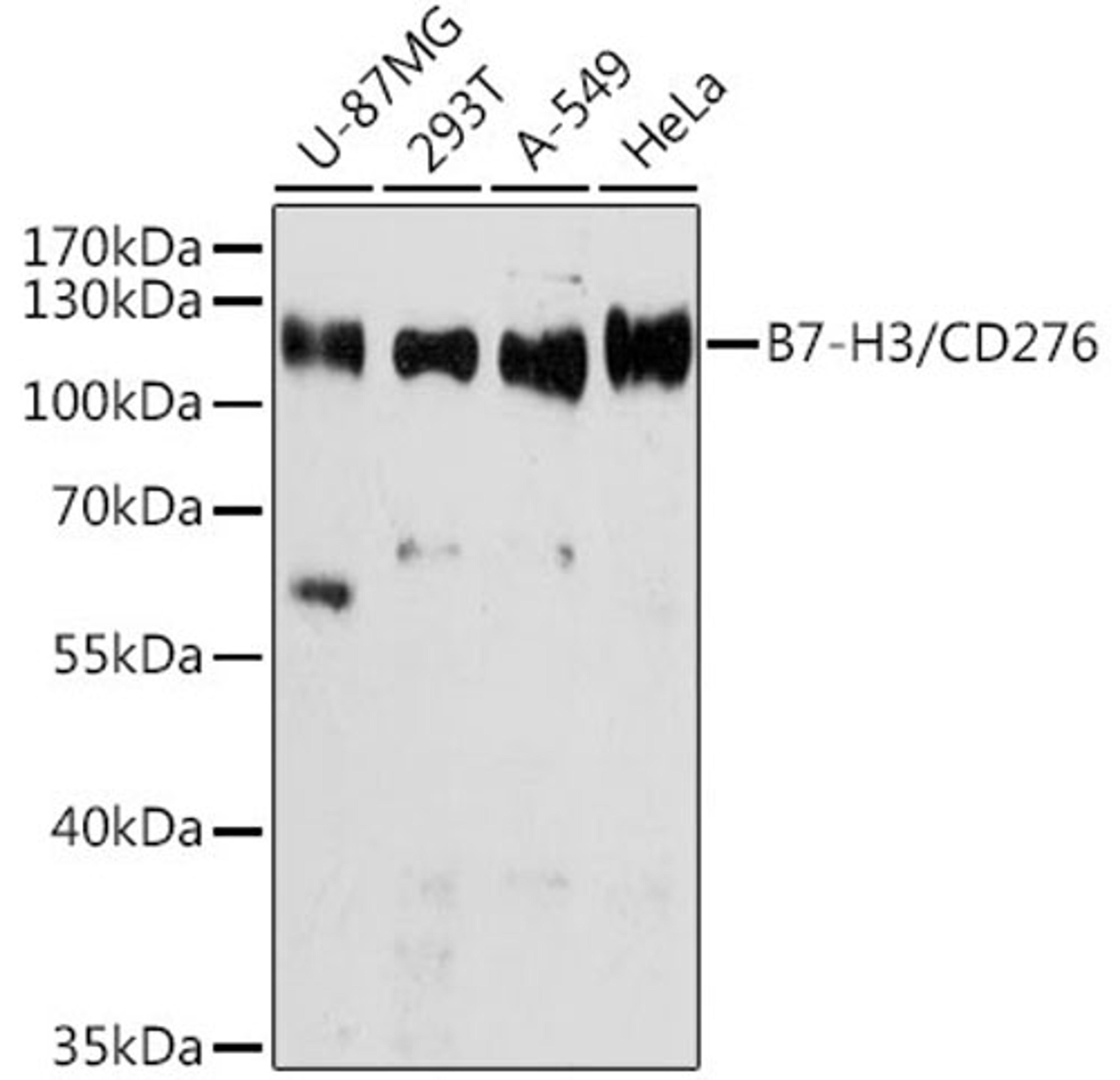 Western blot - B7-H3/CD276 antibody (A10347)