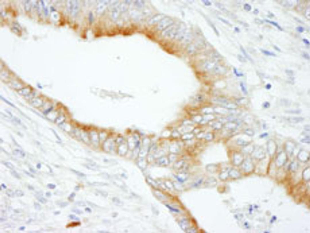 Detection of human MAP7 by immunohistochemistry.