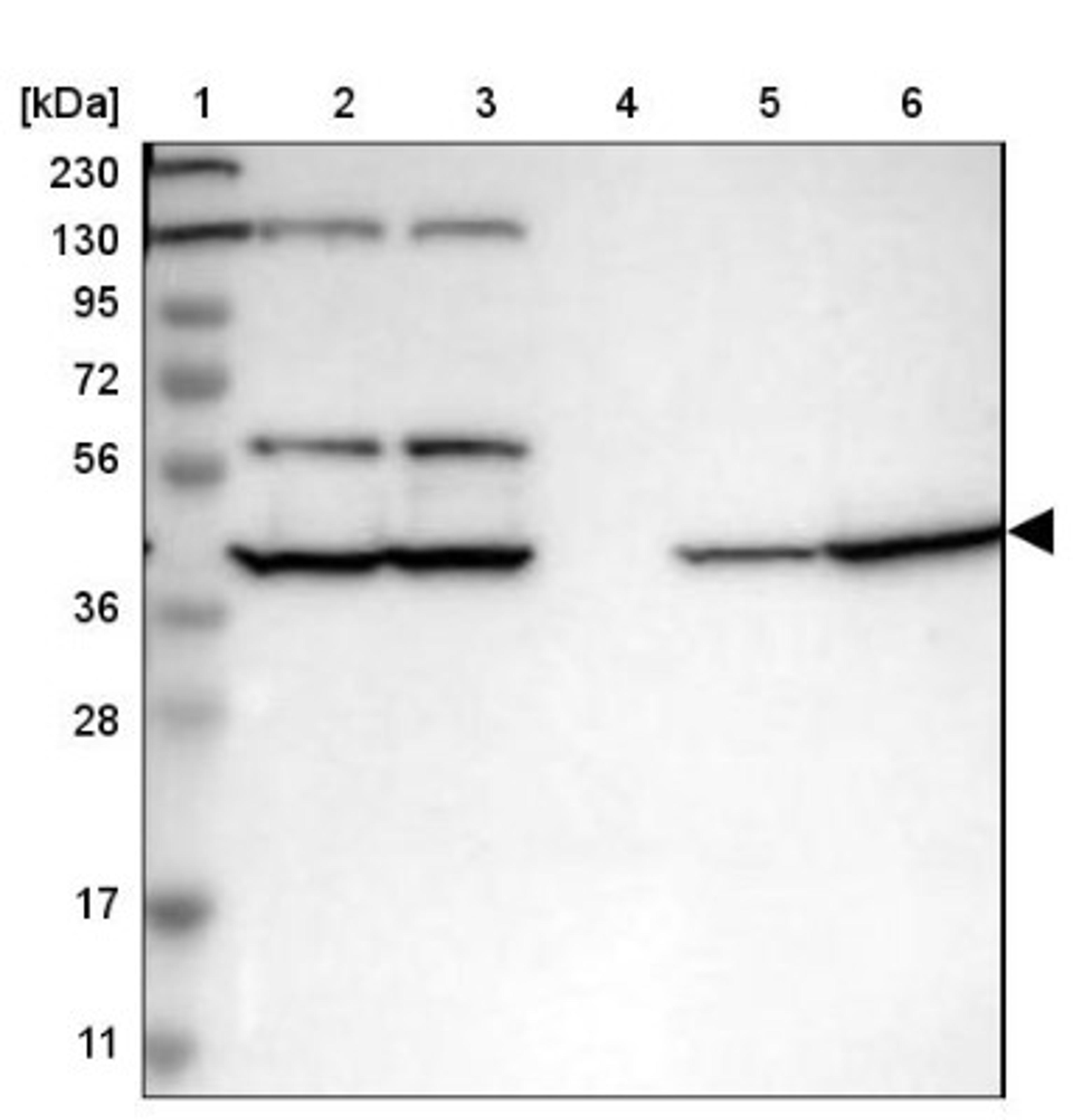 Western Blot: Septin-2 Antibody [NBP1-85212] - Lane 1: Marker [kDa] 230, 130, 95, 72, 56, 36, 28, 17, 11<br/>Lane 2: Human cell line RT-4<br/>Lane 3: Human cell line U-251MG sp<br/>Lane 4: Human plasma (IgG/HSA depleted)<br/>Lane 5: Human liver tissue<br/>Lane 6: Human tonsil tissue