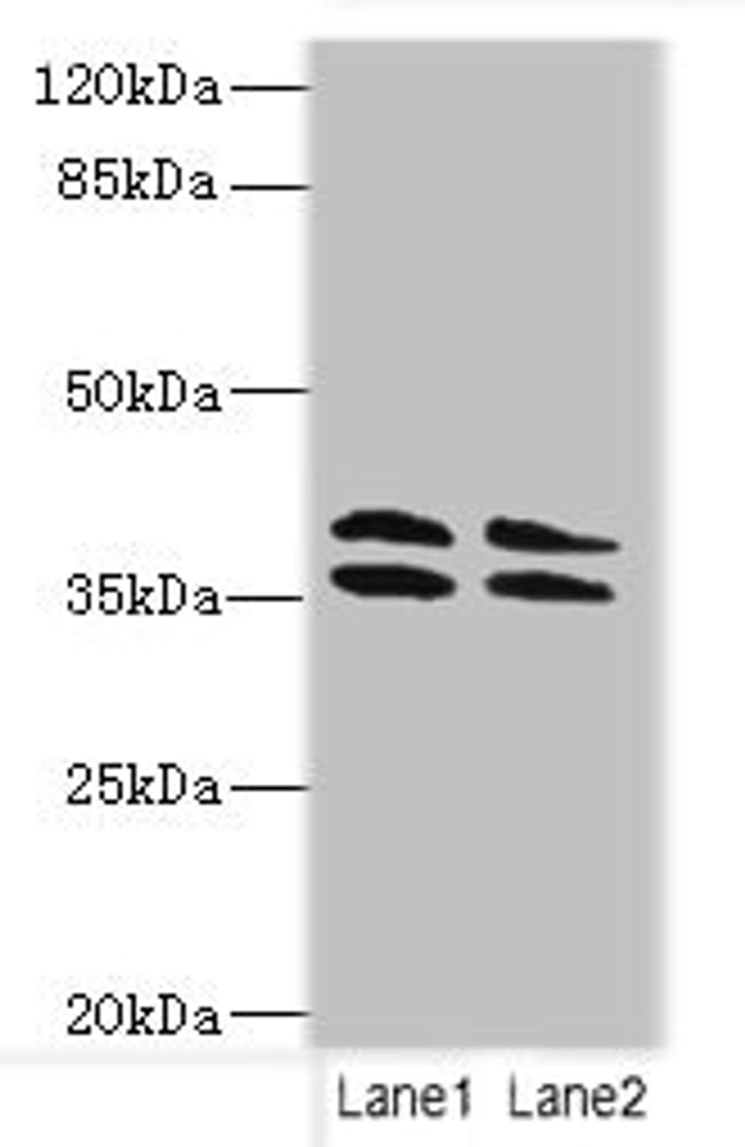 Western blot. All lanes: CA10 antibody at 4ug/ml. Lane 1: HL60 whole cell lysate. Lane 2: Mouse brain tissue. Secondary. Goat polyclonal to rabbit IgG at 1/10000 dilution. Predicted band size: 38, 30 kDa. Observed band size: 38 kDa. 