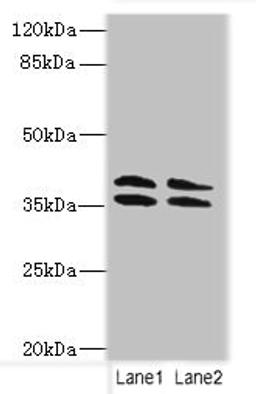 Western blot. All lanes: CA10 antibody at 4ug/ml. Lane 1: HL60 whole cell lysate. Lane 2: Mouse brain tissue. Secondary. Goat polyclonal to rabbit IgG at 1/10000 dilution. Predicted band size: 38, 30 kDa. Observed band size: 38 kDa. 