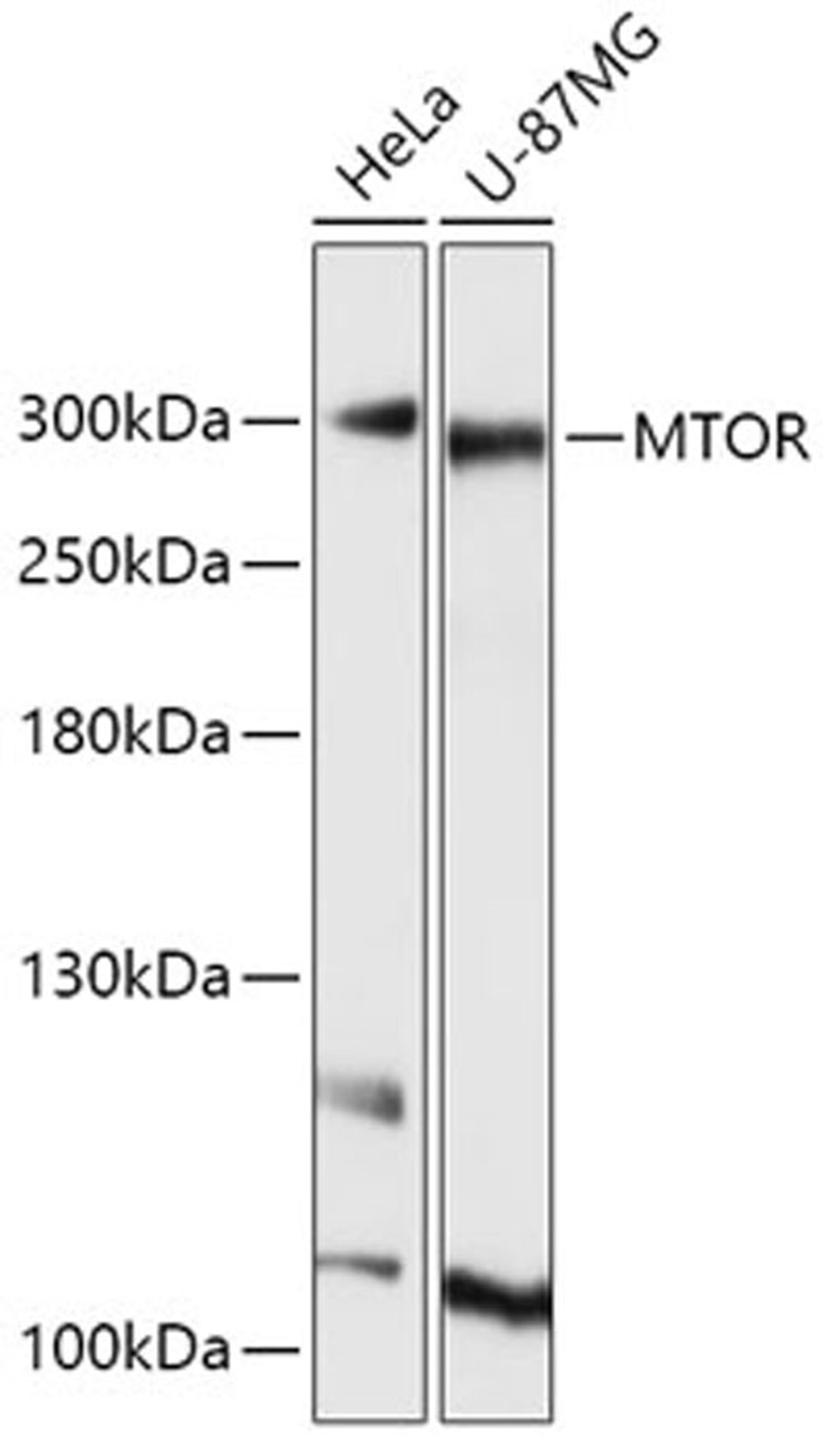 Western blot - mTOR  antibody (A11354)