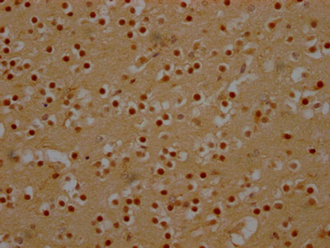 IHC image of CSB-RA180423A0HU diluted at 1:100 and staining in paraffin-embedded human brain tissue performed on a Leica BondTM system. After dewaxing and hydration, antigen retrieval was mediated by high pressure in a citrate buffer (pH 6.0). Section was blocked with 10% normal goat serum 30min at RT. Then primary antibody (1% BSA) was incubated at 4℃ overnight. The primary is detected by a Goat anti-rabbit IgG polymer labeled by HRP and visualized using 0.05% DAB.