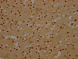 IHC image of CSB-RA180423A0HU diluted at 1:100 and staining in paraffin-embedded human brain tissue performed on a Leica BondTM system. After dewaxing and hydration, antigen retrieval was mediated by high pressure in a citrate buffer (pH 6.0). Section was blocked with 10% normal goat serum 30min at RT. Then primary antibody (1% BSA) was incubated at 4℃ overnight. The primary is detected by a Goat anti-rabbit IgG polymer labeled by HRP and visualized using 0.05% DAB.