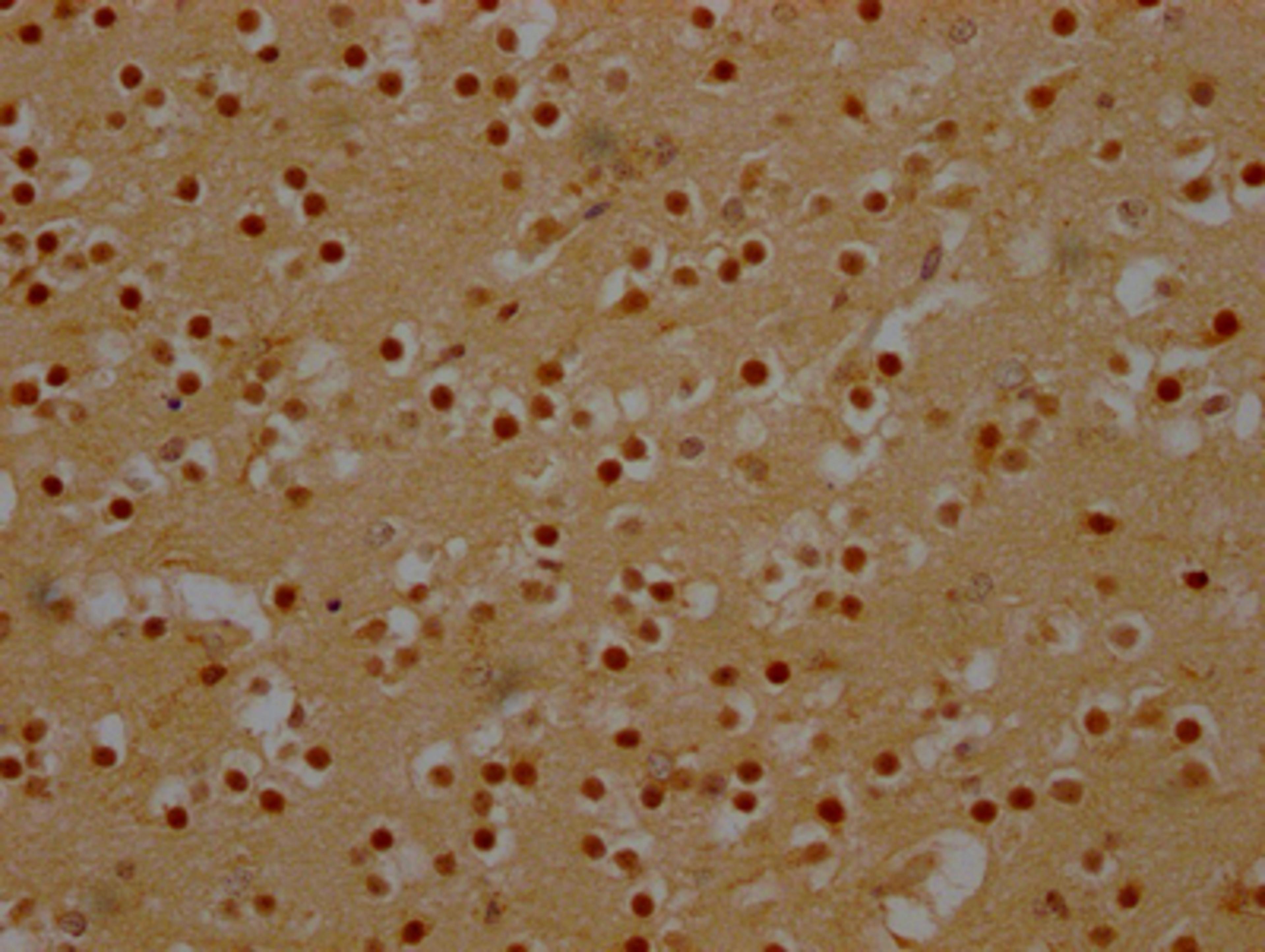 IHC image of CSB-RA180423A0HU diluted at 1:100 and staining in paraffin-embedded human brain tissue performed on a Leica BondTM system. After dewaxing and hydration, antigen retrieval was mediated by high pressure in a citrate buffer (pH 6.0). Section was blocked with 10% normal goat serum 30min at RT. Then primary antibody (1% BSA) was incubated at 4℃ overnight. The primary is detected by a Goat anti-rabbit IgG polymer labeled by HRP and visualized using 0.05% DAB.