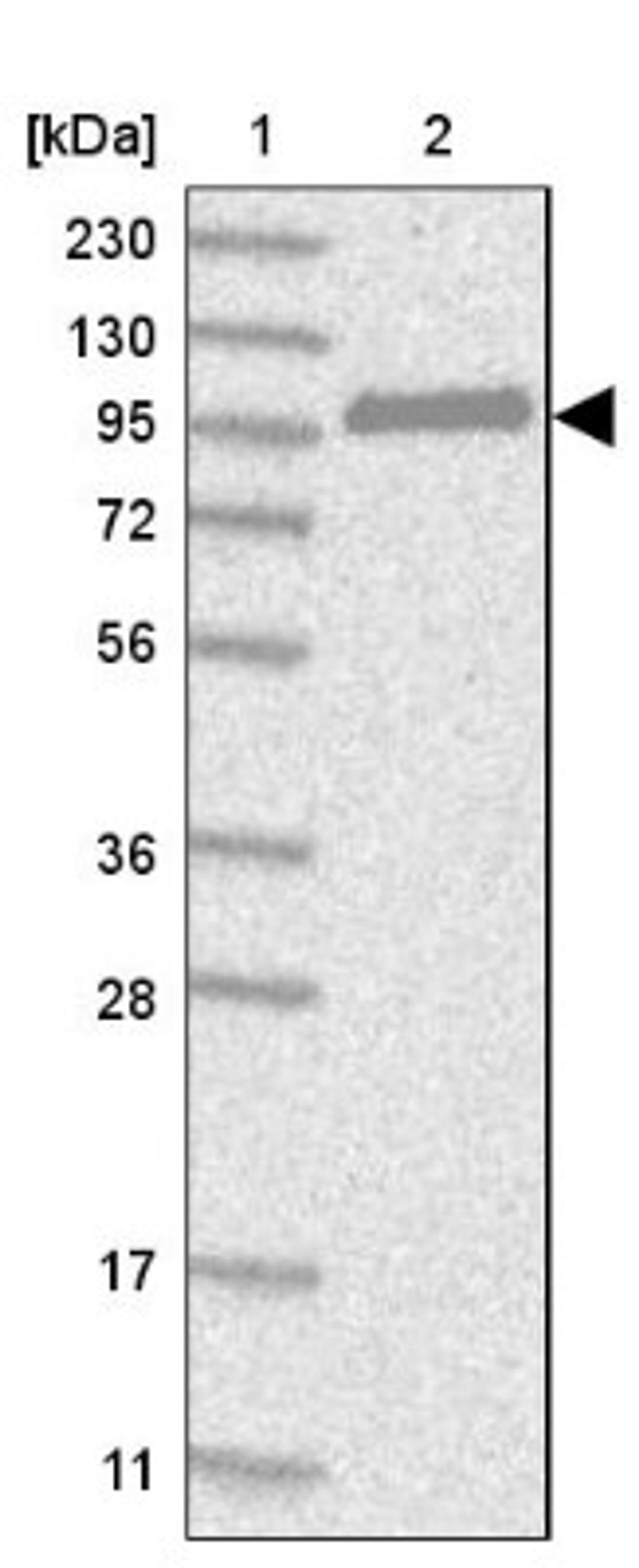 Western Blot: CNKSR1 Antibody [NBP1-84420] - Lane 1: Marker [kDa] 230, 130, 95, 72, 56, 36, 28, 17, 11<br/>Lane 2: Human cell line RT-4