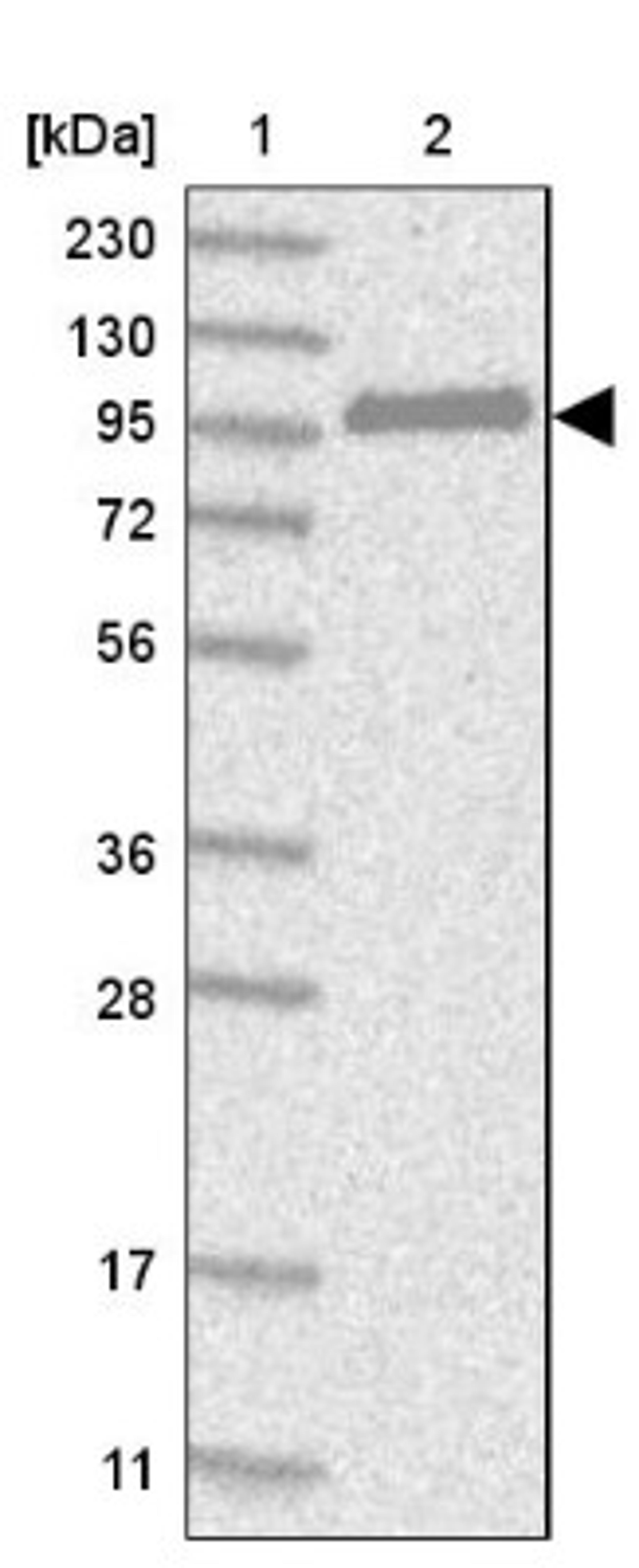 Western Blot: CNKSR1 Antibody [NBP1-84420] - Lane 1: Marker [kDa] 230, 130, 95, 72, 56, 36, 28, 17, 11<br/>Lane 2: Human cell line RT-4