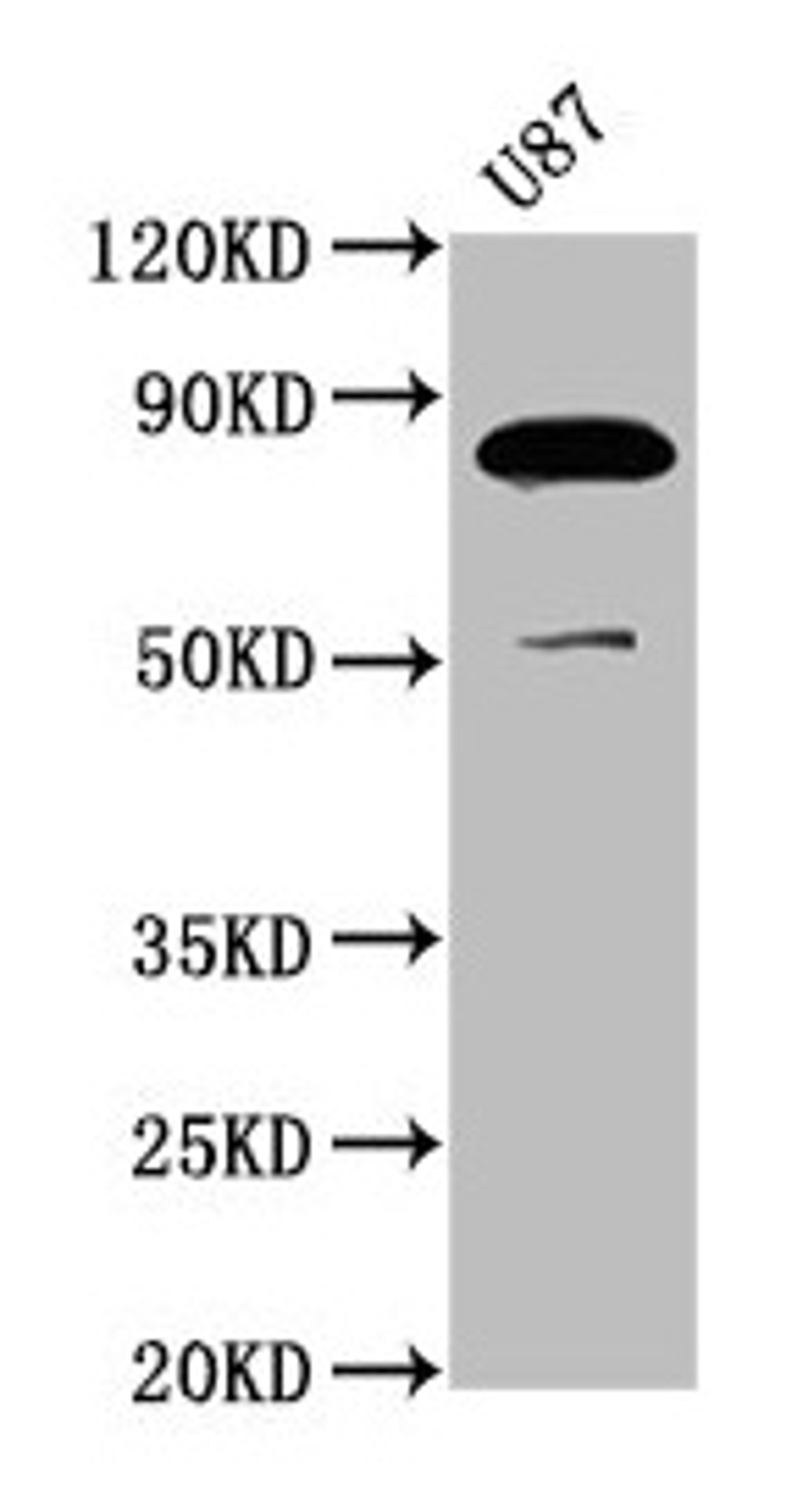Western Blot. Positive WB detected in: U87 whole cell lysate. All lanes: FRMD7 antibody at 3.7µg/ml. Secondary. Goat polyclonal to rabbit IgG at 1/50000 dilution. Predicted band size: 82, 80 kDa. Observed band size: 82 kDa