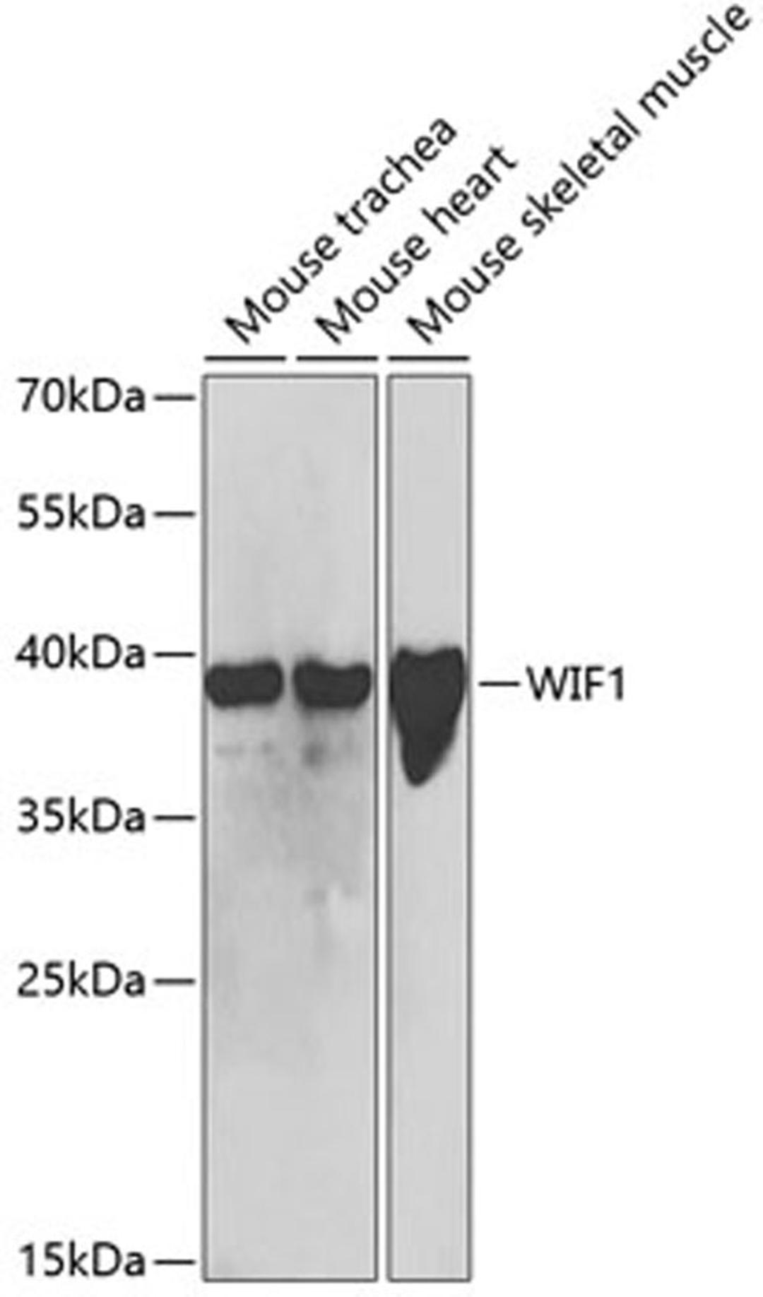 Western blot - WIF1 antibody (A5386)