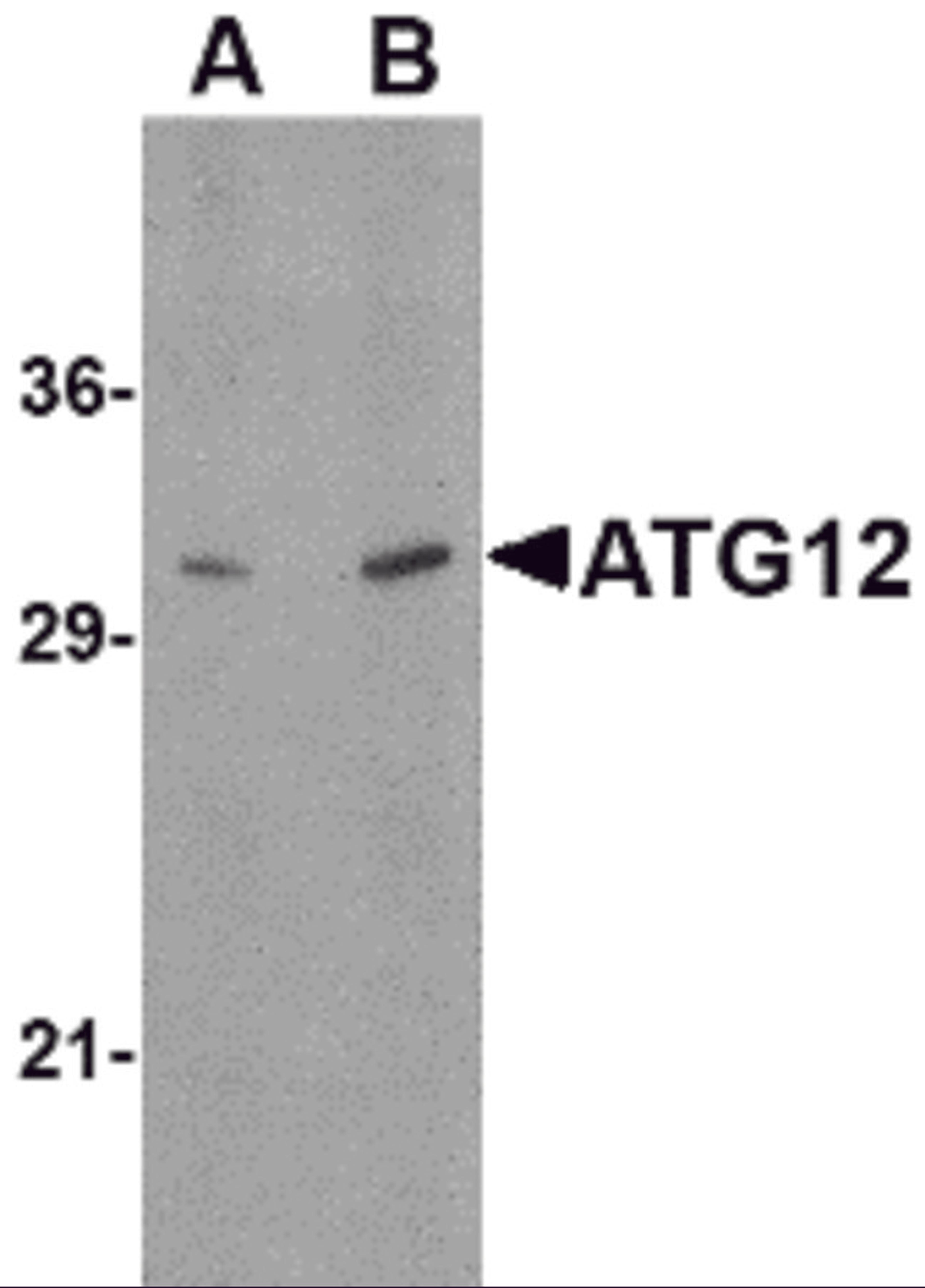 Western blot analysis of ATG12 in human brain tissue lysate with ATG12 antibody at (A) 0.5, and (B) 1 &#956;g/mL.