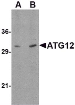 Western blot analysis of ATG12 in human brain tissue lysate with ATG12 antibody at (A) 0.5, and (B) 1 μg/mL.