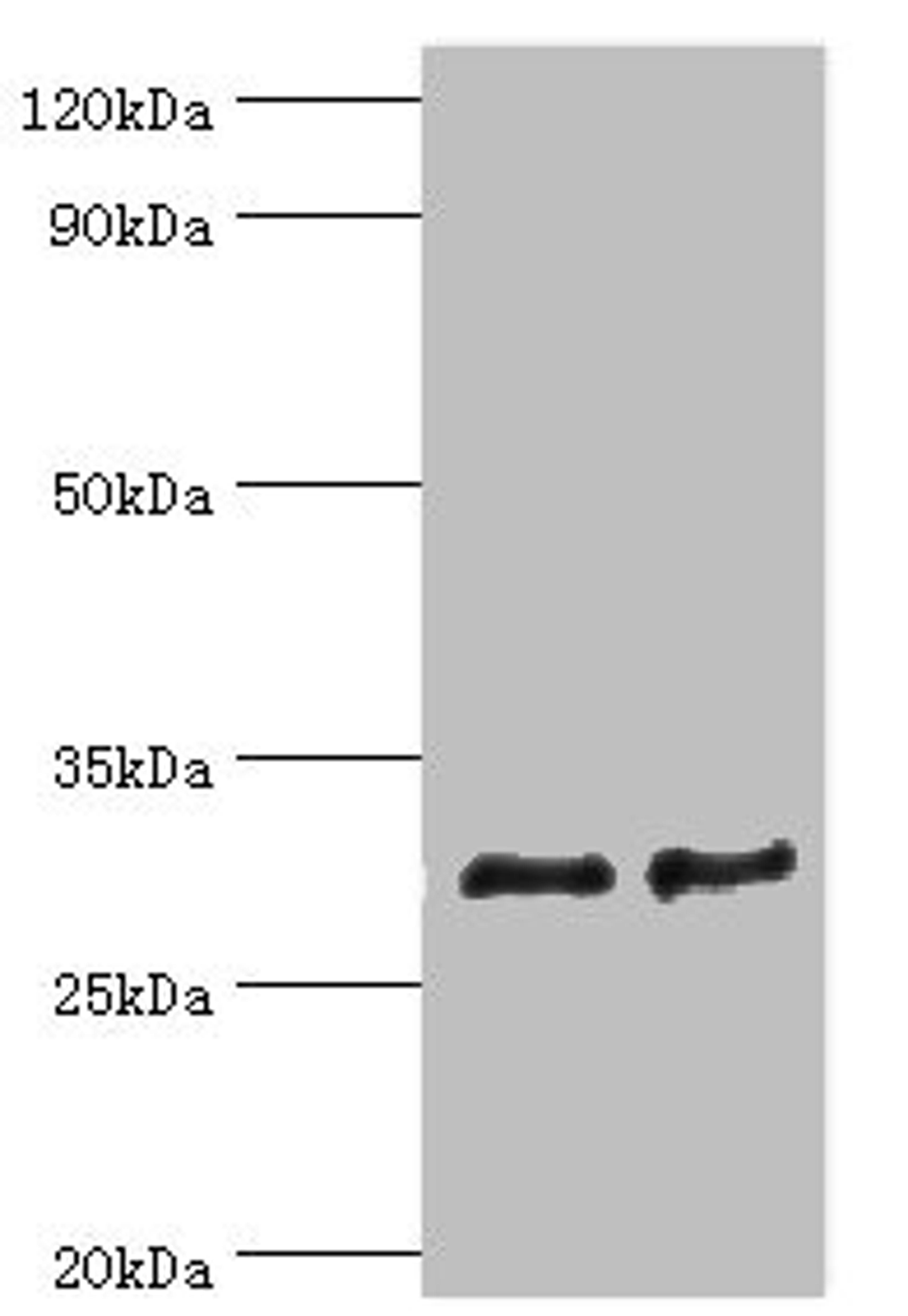 Western blot. All lanes: ATP synthase F (0) complex subunit B1, mitochondrial antibody at 4ug/ml. Lane 1: Mouse heart tissue. Lane 2: Mouse skeletal muscle tissue. Secondary. Goat polyclonal to rabbit IgG at 1/10000 dilution. Predicted band size: 29 kDa. Observed band size: 29 kDa. 